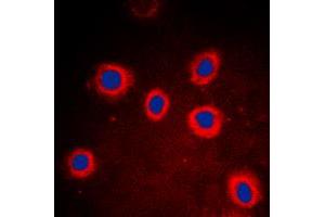 Immunofluorescent analysis of Cytokeratin 8 staining in DLD cells. (KRT8 Antikörper  (Center))
