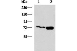 Western blot analysis of Jurkat and Raji cell lysates using PUM3 Polyclonal Antibody at dilution of 1:800 (Pumilio 3 Antikörper)