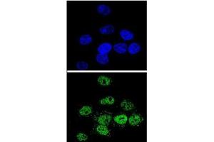 Confocal immunofluorescent analysis of MEF2A Antibody (Center) Cat. (MEF2A Antikörper  (Middle Region))