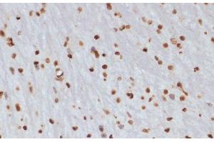 Immunohistochemistry of paraffin-embedded Mouse brain using Phospho-CHEK1(S280) Polyclonal Antibody at dilution of 1:100 (40x lens). (CHEK1 Antikörper  (pSer280))