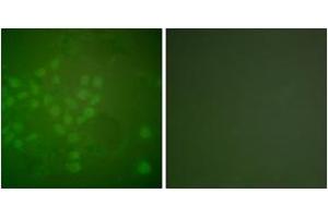 Immunofluorescence analysis of A549 cells, using RAD17 (Ab-645) Antibody.