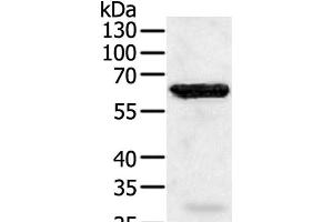 Western Blot analysis of Jurkat cell using TRAF5 Polyclonal Antibody at dilution of 1:450 (TRAF5 Antikörper)