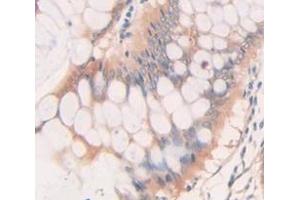 IHC-P analysis of Human Tissue, with DAB staining. (BMP2 Antikörper  (AA 283-396))