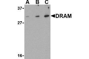 Western blot analysis of DRAM in K562 cell lysate with DRAM antibody at (A) 0.