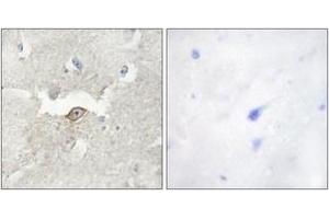 Immunohistochemistry analysis of paraffin-embedded human brain tissue, using LMTK2 Antibody.