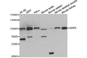 Western blot analysis of extracts of various cell lines, using QARS antibody. (QARS Antikörper)