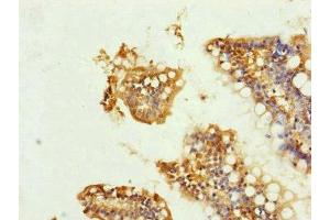 Immunohistochemistry (IHC) image for anti-Ubiquinol-Cytochrome C Reductase Core Protein I (UQCRC1) (AA 156-480) antibody (ABIN7149102)