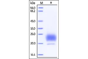 Human HE4, His Tag on SDS-PAGE under reducing (R) condition. (WFDC2 Protein (AA 31-124) (His tag))