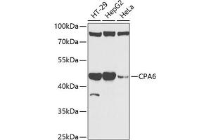 Western blot analysis of extracts of various cell lines, using CP antibody (ABIN6129673, ABIN6138930, ABIN6138932 and ABIN6217722) at 1:1000 dilution. (CPA6 Antikörper  (AA 130-437))