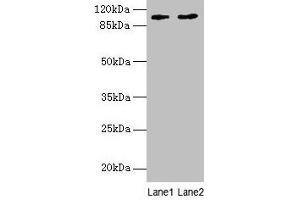 Western blot All lanes: CCDC57 antibody at 1. (CCDC57 Antikörper  (AA 1-300))