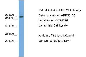 WB Suggested Anti-ARHGEF19  Antibody Titration: 0. (ARHGEF19 Antikörper  (Middle Region))