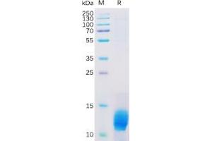 Human MUC1 Protein, His Tag on SDS-PAGE under reducing condition. (MUC1 Protein (His tag))