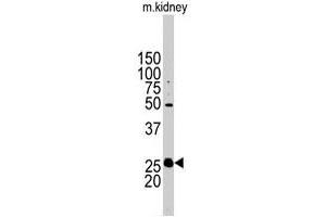 Western blot analysis of STC2 polyclonal antibody  in mouse kidney tissue lysates (35 ug/lane). (Stanniocalcin 2 Antikörper  (N-Term))