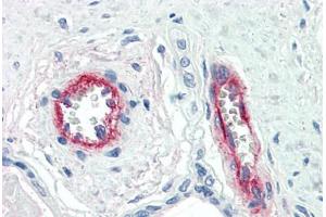 Human Placenta, Vessels (formalin-fixed, paraffin-embedded) stained with F8 antibody ABIN396921 at 10 ug/ml followed by biotinylated anti-mouse IgG secondary antibody ABIN481714, alkaline phosphatase-streptavidin and chromogen. (Factor VIII Antikörper)