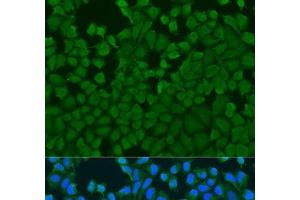 Immunofluorescence analysis of U2OS cells using IL27RA Polyclonal Antibody at dilution of 1:100. (IL27 Receptor alpha Antikörper)
