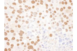 Immunohistochemistry (IHC) image for anti-Interleukin Enhancer Binding Factor 2, 45kDa (ILF2) (AA 340-390) antibody (ABIN7453441) (ILF2 Antikörper  (AA 340-390))