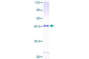 Image no. 1 for Notch 2 N-terminal Like (NOTCH2NL) (AA 1-236) protein (GST tag) (ABIN1312813) (NOTCH2NL Protein (AA 1-236) (GST tag))