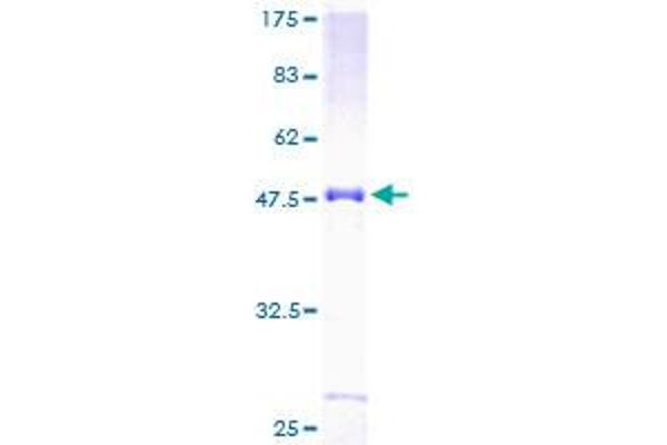 NOTCH2NL Protein (AA 1-236) (GST tag)