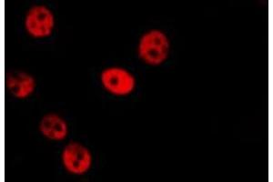ABIN6279703 staining Hela by IF/ICC. (SFRS14 Antikörper  (Internal Region))