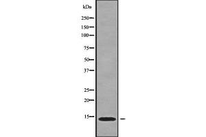 Western blot analysis of CCL16 using HT29 whole cell lysates (CCL16 Antikörper  (N-Term))