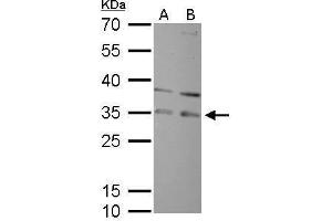 WB Image RPA32 antibody detects RPA2 protein by Western blot analysis.