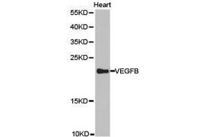 Western Blotting (WB) image for anti-Vascular Endothelial Growth Factor B (VEGFB) antibody (ABIN1875323) (VEGFB Antikörper)