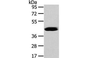 Gel: 8 % SDS-PAGE, Lysate: 40 μg, Lane: Hela cell, Primary antibody: ABIN7128077(VASH2 Antibody) at dilution 1/450 dilution, Secondary antibody: Goat anti rabbit IgG at 1/8000 dilution, Exposure time: 40 seconds (Vasohibin 2 Antikörper)