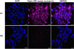 Immunocytochemical staining of HeLa cells using Aladin WD repeat nucleoporin antibody (ABIN7797447), 1:1,000), Top panel: wild-type (WT), Bottom panal: Aladin WD repeat nucleoporin shRNA knockdown (KD).