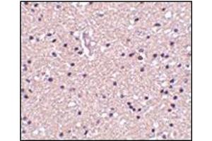 Immunohistochemistry of op18 in human brain tissue with this product at 2. (Stathmin 1 Antikörper  (N-Term))