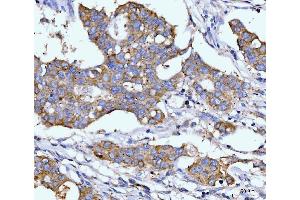 IHC analysis of DHODH using anti-DHODH antibody (ABIN7603139). (DHODH Antikörper  (N-Term))