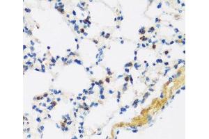 Immunohistochemistry of paraffin-embedded Mouse lung using APOBEC3F Polyclonal Antibody at dilution of 1:100 (40x lens). (APOBEC3F Antikörper)