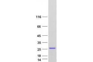 Validation with Western Blot (HRAS Protein (Transcript Variant 3) (Myc-DYKDDDDK Tag))