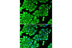 Immunofluorescence analysis of U2OS cells using MAPK8 antibody (ABIN5975840). (JNK Antikörper)