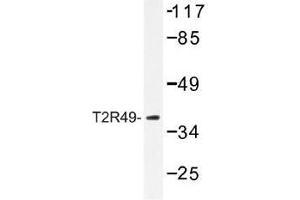 Image no. 1 for anti-Taste Receptor, Type 2, Member 49 (TAS2R20) antibody (ABIN317774) (TAS2R20 Antikörper)
