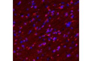 Immunofluorescent analysis of paraformaldehyde-fixed mouse brain using VMAT2 (ABIN7075655) at dilution of 1: 1600 (SLC18A2 Antikörper)