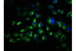 Immunofluorescence staining of Hela cells with ABIN7173546 at 1:66, counter-stained with DAPI. (TRO Antikörper  (AA 1-164))
