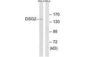 Western blot analysis of extracts from HeLa cells, using DSG2 Antibody. (Desmoglein 2 Antikörper  (AA 401-450))