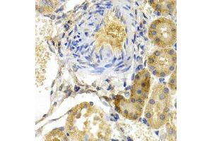 Immunohistochemistry (IHC) image for anti-BCL2-Associated Agonist of Cell Death (BAD) (C-Term) antibody (ABIN6218665)
