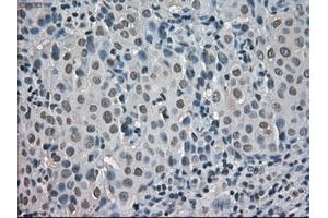Immunohistochemical staining of paraffin-embedded pancreas tissue using anti-CRYABmouse monoclonal antibody. (CRYAB Antikörper)