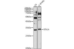 Western blot analysis of extracts of various cell lines, using STX1A antibody (ABIN7270684) at 1:1000 dilution. (STX1A Antikörper)