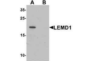 Western blot analysis of LEMD1 in A20 cell lysate with LEMD1 Antibody  at 1 ug/mL in (A) the absence and (B) the presence of blocking peptide. (LEMD1 Antikörper  (Middle Region))