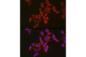 Immunofluorescence analysis of U2OS cells using Sterol carrier protein 2 antibody (ABIN7270597) at dilution of 1:50. (SCP2 Antikörper)