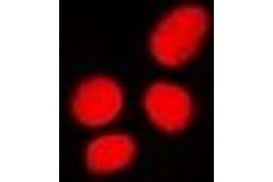 Immunofluorescent analysis of PHC3 staining in U2OS cells. (PHC3 Antikörper)