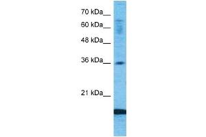 Host:  Rabbit  Target Name:  CCL18  Sample Type:  Fetal Lung lysates  Antibody Dilution:  1. (CCL18 Antikörper  (Middle Region))