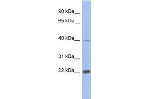 WB Suggested Anti-PSMA4 Antibody Titration: 0. (PSMA4 Antikörper  (N-Term))