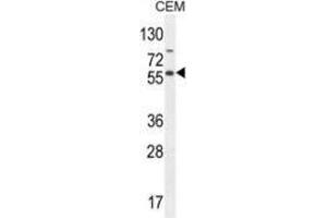 Western blot analysis in CEM cell line lysates (35ug/lane) using NFKBIL1  Antibody . (NFKBIL1 Antikörper  (Middle Region))