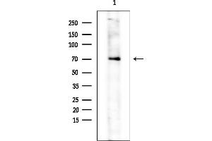 anti-Fibroblast Growth Factor Receptor Substrate 2 (FRS2) (pTyr436) antibody