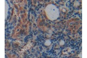 Used in DAB staining on fromalin fixed paraffin- embedded rectum tissue (PLXNB1 Antikörper  (AA 200-727))