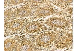 IGF2BP3 Mouse Monoclonal Antibody at 1/100 staining human normal colon tissue by IHC-P. (IGF2BP3 Antikörper)