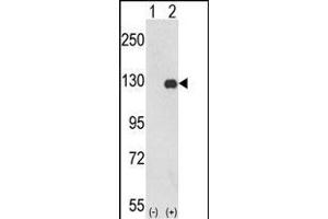 Western blot analysis of PTK2 (arrow) using rabbit polyclonal PTK2 Antibody (C-term) (ABIN652554 and ABIN2842372). (FAK Antikörper  (C-Term))